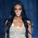 winnie-harlow-1536431248