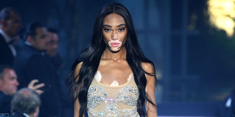 winnie-harlow-1536431248