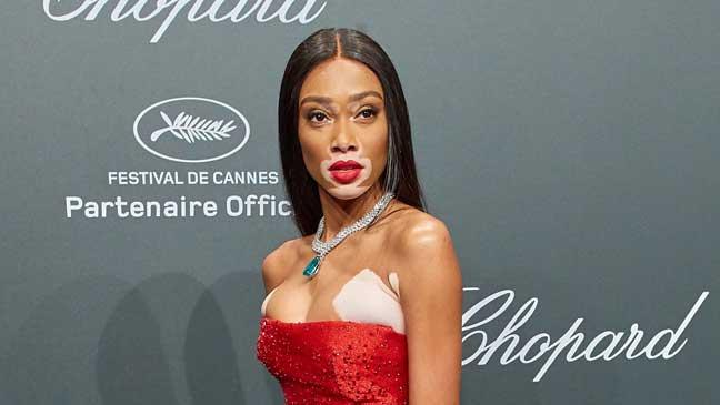 winnie-harlow-at-cannes-136418425943703901-170531135113